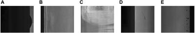 Multiclass small target detection algorithm for surface defects of chemicals special steel